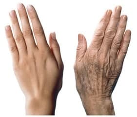 hand skin anti-ageing care